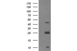 Western Blotting (WB) image for anti-Aldehyde Dehydrogenase 1 Family, Member A3 (ALDH1A3) (AA 1-100), (AA 413-512) antibody (ABIN1490538) (ALDH1A3 anticorps  (AA 1-100, AA 413-512))