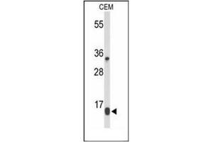 Western blot analysis of DIRAS1 Antibody in CEM cell line lysates (35ug/lane).