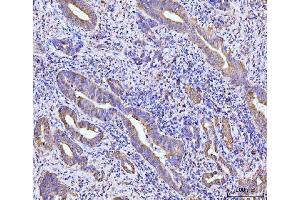 IHC analysis of RPL29 using anti-RPL29 antibody (ABIN7600993). (RPL29 anticorps  (AA 27-153))