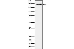 Western blot analysis of Phospho-LRP6  expression in heLa treated with Calyculin cell lysate.