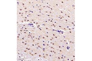 Immunohistochemistry of paraffin embedded mouse brain using ZNF498 (ABIN7076253) at dilution of 1:4000 (400x lens)