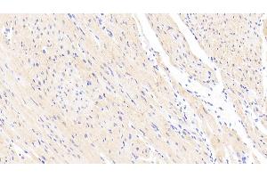 Detection of CNN2 in Human Cardiac Muscle Tissue using Polyclonal Antibody to Calponin 2 (CNN2)