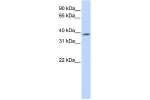 WB Suggested Anti-MBD2 Antibody Titration:  0. (MBD2 anticorps  (N-Term))