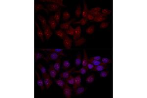 Confocal immunofluorescence analysis of Hela cells using EIF6 antibody (ABIN3022602, ABIN3022603, ABIN3022604 and ABIN6218936) at dilution of 1:50. (EIF6 anticorps  (AA 1-245))