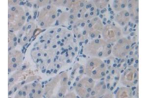 DAB staining on IHC-P; Samples: Rat Kidney Tissue