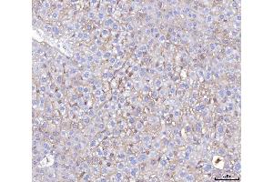IHC analysis of Poliovirus Receptor/PVR using anti-Poliovirus Receptor/PVR antibody (ABIN7601070).