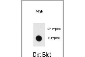 Dot blot analysis of anti-Phospho-MBP- Antibody (ABIN389939 and ABIN2839752) on nitrocellulose membrane. (MBP anticorps  (pTyr203))
