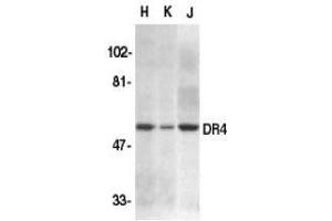 Western blot analysis of DR4 in HeLa (H), K562 (K), and Jurkat (J) whole cell lysate with AP30300PU-N DR4 antibody at 1/500 dilution. (TNFRSF10A anticorps  (N-Term))