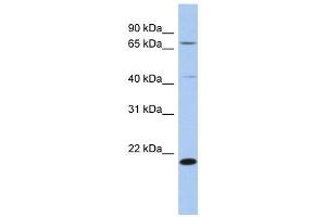 AMD1 antibody used at 1 ug/ml to detect target protein.