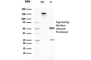 SDS-PAGE Analysis of Purified MMP3 Mouse Monoclonal Antibody (MMP3/2806).