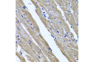 Immunohistochemistry of paraffin-embedded rat heart using DFNA5 antibody at dilution of 1:100 (x40 lens). (DFNA5 anticorps)