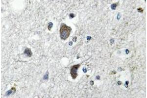 Image no. 1 for anti-Heat Shock Protein 70 (HSP70) antibody (ABIN317710)