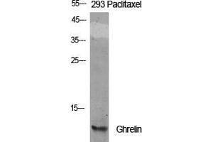 Western Blot (WB) analysis of specific cells using Ghrelin Polyclonal Antibody. (Ghrelin anticorps  (Internal Region))