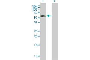 Western Blot analysis of ATP5B expression in transfected 293T cell line by ATP5B MaxPab polyclonal antibody. (ATP5B anticorps  (AA 1-529))