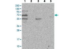 Western blot analysis of Lane 1: RT-4, Lane 2: U-251 MG, Lane 3: Human Plasma, Lane 4: Liver, Lane 5: Tonsil with SOWAHB polyclonal antibody . (SOWAHB anticorps)
