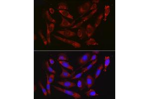 Immunofluorescence analysis of U2OS cells using CD47 Rabbit pAb (ABIN3022623, ABIN3022624, ABIN3022625, ABIN1512716 and ABIN6218964) at dilution of 1:50 (40x lens).