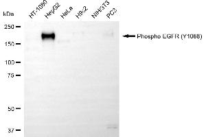 Western blotting analysis using phospho-EGFR (Y) antibody (ABIN7798468).