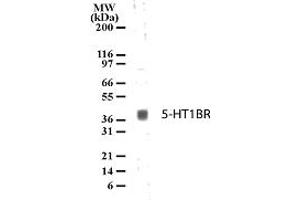 Image no. 1 for anti-Serotonin Receptor 1B (HTR1B) (AA 8-26) antibody (ABIN208265) (5HT1B Receptor anticorps  (AA 8-26))