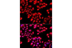Immunofluorescence analysis of A549 cells using XRCC6 antibody. (XRCC6 anticorps  (AA 408-609))
