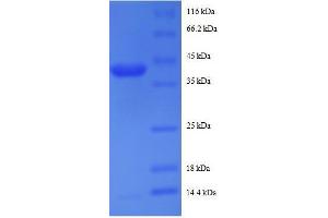 RPS19BP1 Protein (AA 1-145, full length) (GST tag)
