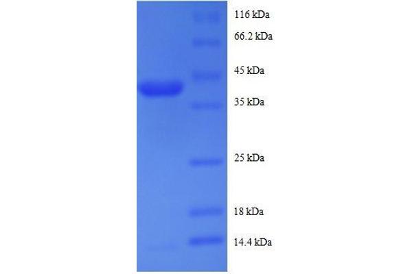 RPS19BP1 Protein (AA 1-145, full length) (GST tag)
