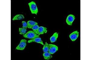 Confocal immunofluorescent analysis of DJ-1 antibody with HeLa cells followed by Alexa Fluor 488-conjugated goat anti-rabbit lgG (green).