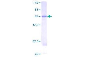 Image no. 1 for Activator of HSP90 ATPase Activity 1 (AHSA1) (AA 1-338) protein (GST tag) (ABIN1344648)