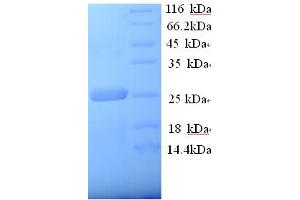 SDS-PAGE (SDS) image for Low Density Lipoprotein Receptor-Related Protein 2 (LRP2) (AA 1186-1389), (Extracellular) protein (His tag) (ABIN5713618)