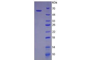 SDS-PAGE analysis of Human BIRC2 Protein. (BIRC2 Protéine)