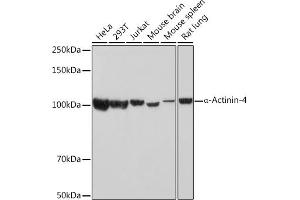 Western blot analysis of extracts of various cell lines, using α-Actinin-4 Rabbit mAb (ABIN7265399) at 1:1000 dilution. (alpha Actinin 4 anticorps)