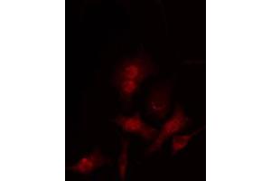 ABIN6267697 staining Hela by IF/ICC.