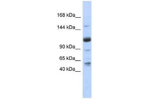 WB Suggested Anti-SR140 Antibody Titration:  0. (SR140 anticorps  (N-Term))