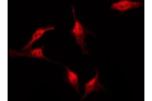 ABIN6267479 staining SW626 by IF/ICC.