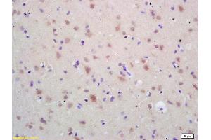 Formalin-fixed and paraffin embedded rat brain labeled with Rabbit Anti HSP60 Polyclonal Antibody, Unconjugated (ABIN726080) at 1:200 followed by conjugation to the secondary antibody and DAB staining (HSPD1 anticorps  (AA 501-573))