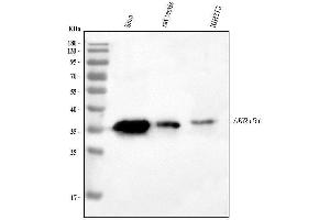 Western blot analysis of AKR1B1 using anti-AKR1B1 antibody (ABIN4886447).