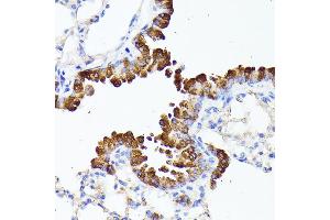 Immunohistochemistry of paraffin-embedded mouse lung using SMYD4 antibody (ABIN6133038, ABIN6148171, ABIN6148172 and ABIN6223147) at dilution of 1:100 (40x lens). (SMYD4 anticorps  (AA 1-260))