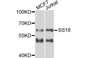 Western blot analysis of extracts of MCF7 and Jurkat cells, using SS18 antibody. (SS18 anticorps)
