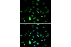 Immunofluorescence analysis of A549 cell using CCNB1 antibody. (Cyclin B1 anticorps  (C-Term))