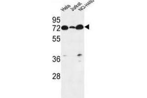 Western Blotting (WB) image for anti-Lipid Phosphate Phosphatase-Related Protein Type 4 (LPPR4) antibody (ABIN3002187) (LPPR4 anticorps)