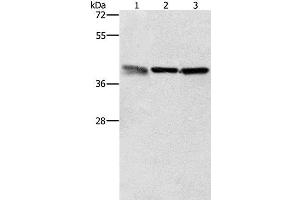 Western Blot analysis of A549, K562 and PC3 cell using ZFP42 Polyclonal Antibody at dilution of 1:500 (ZFP42 anticorps)