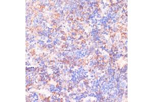 Immunohistochemistry of paraffin-embedded rat spleen using C antibody (ABIN7266010) at dilution of 1:100 (40x lens).