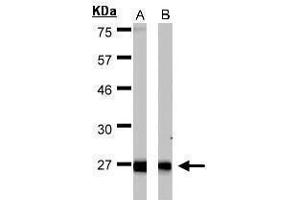 WB Image Sample(30 μg of whole cell lysate) A:HeLa S3, B:MOLT4 , 15% SDS PAGE antibody diluted at 1:1000