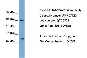 WB Suggested Anti-ATP6V1G2  Antibody Titration: 0. (ATP6V1G2 anticorps  (Middle Region))