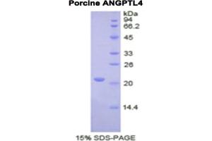 SDS-PAGE analysis of Pig ANGPTL4 Protein. (ANGPTL4 Protéine)