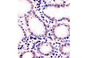 (ABIN6243160 and ABIN6577898) staining (Mouse) Dnmt1 in human stomach tissue sections by Immunohistochemistry (IHC-P - paraformaldehyde-fixed, paraffin-embedded sections).