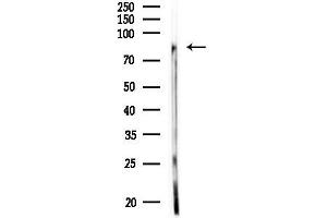 Western blot analysis of lysates from MDA-MB-231 cells, using IKK alpha Antibody at 1/1000 dilution.