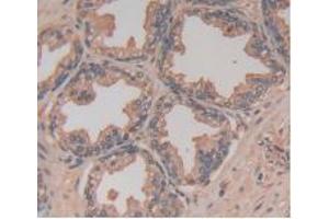 DAB staining on IHC-P; Samples: Human Prostate Gland Tissue (TLR5 anticorps  (AA 693-858))