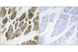 Immunohistochemistry analysis of paraffin-embedded human skeletal muscle tissue, using NMU Antibody. (Neuromedin U anticorps  (AA 125-174))