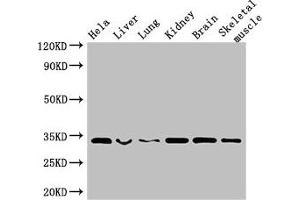 Western Blot Positive WB detected in: Hela whole cell lysate, Mouse liver tissue, Mouse lung tissue, Mouse kidney tissue, Mouse brain tissue, Mouse skeletal muscle tissue All lanes: CNN2 antibody at 2. (CNN2 anticorps  (AA 2-309))