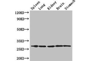 Western Blot Positive WB detected in: Mouse spleen tissue, , Mouse lung tissue, Mouse kidney tissue, Mouse brain tissue, Mouse stomach tissue All lanes: RTP3 antibody at 3 μg/mL Secondary Goat polyclonal to rabbit IgG at 1/50000 dilution Predicted band size: 28 kDa Observed band size: 28 kDa (RTP3 anticorps  (AA 1-211))